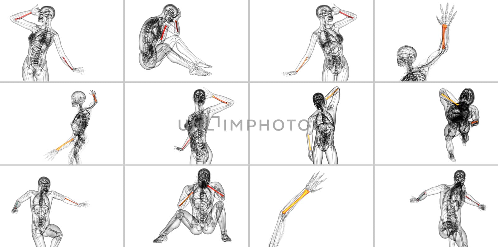 3d rendering medical illustration of the radius bone