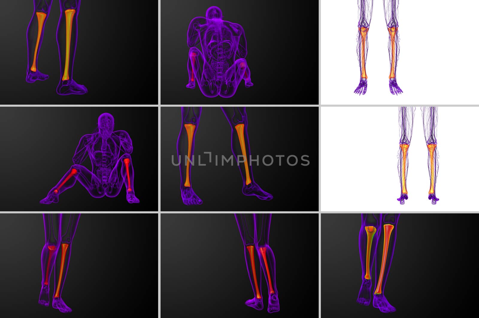3d rendering medical illustration of the tibia bone