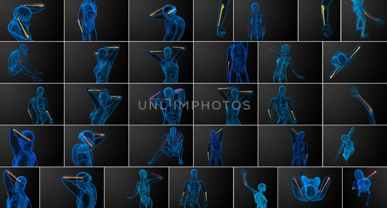 3d rendering  medical illustration of the ulna bone