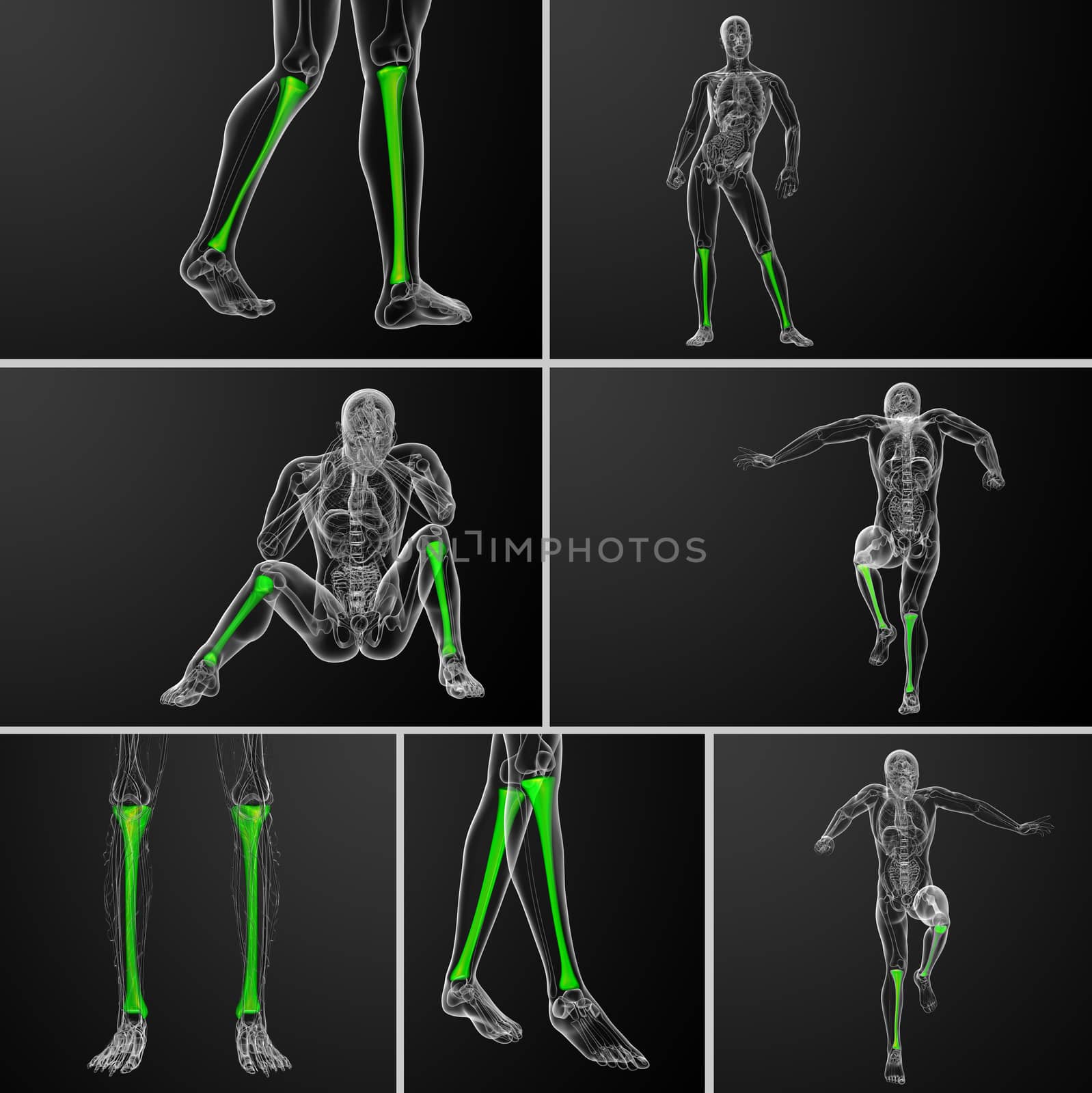 3d rendering medical illustration of the tibia bone 