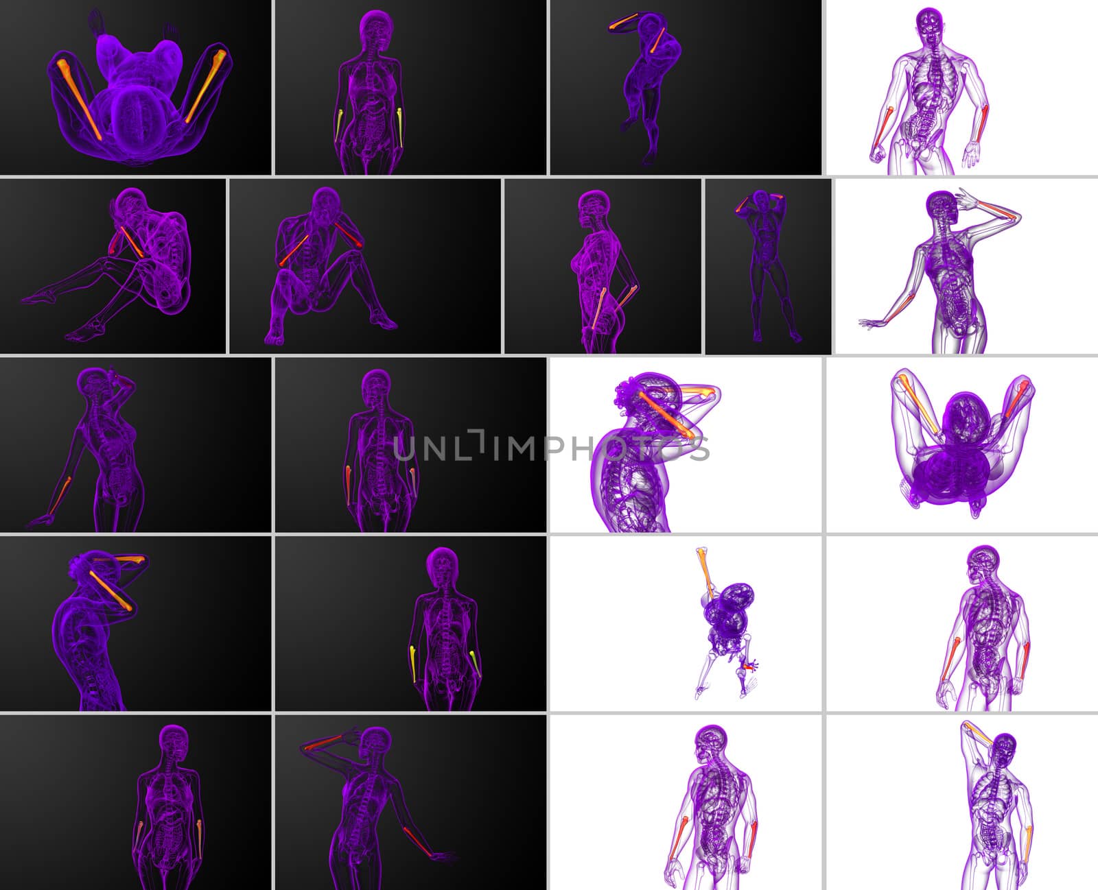 3d rendering medical illustration of the ulna bone 