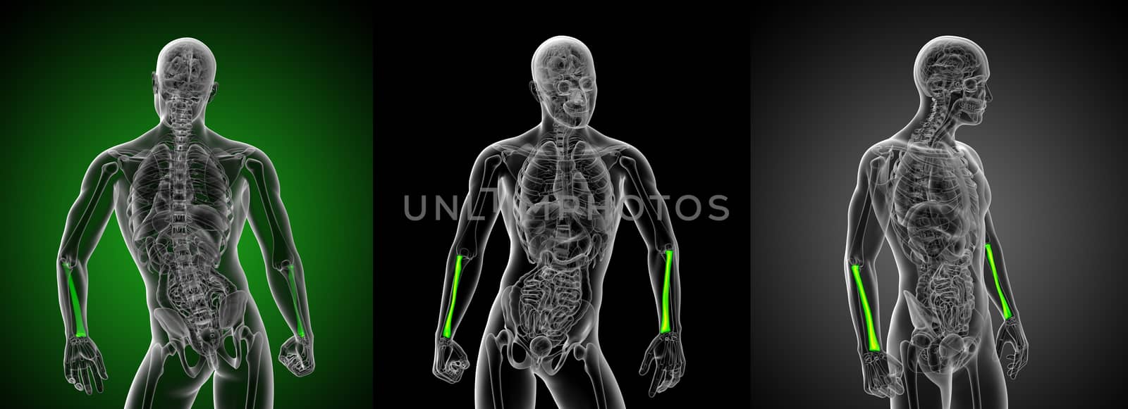 3d rendering medical illustration of the radius bone