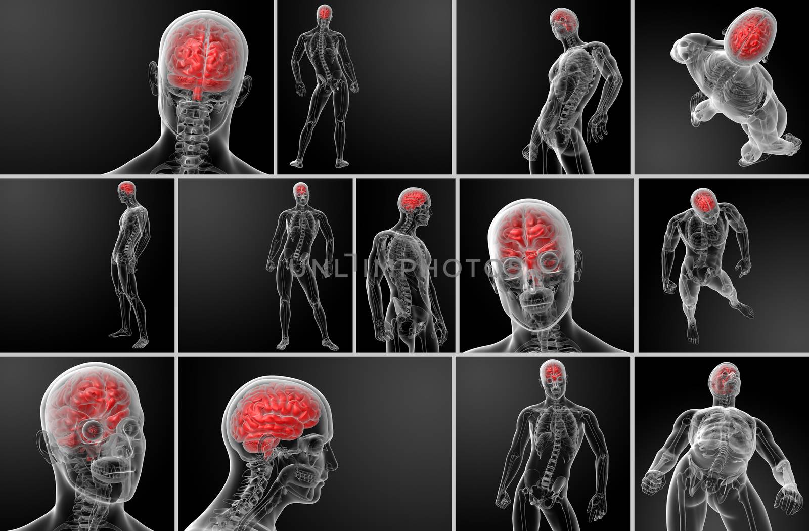 3d rendering human brain X ray