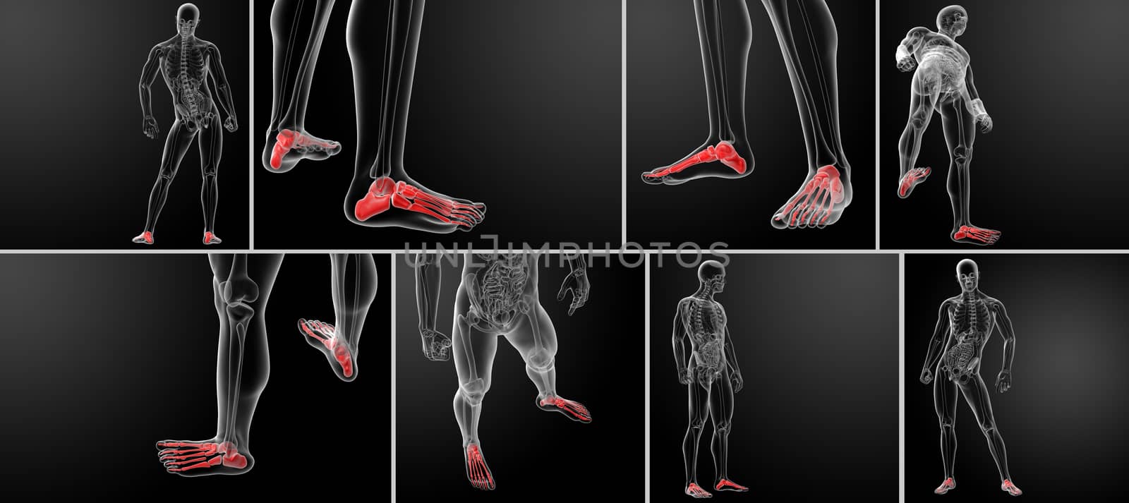 3d rendering x-ray of foot 