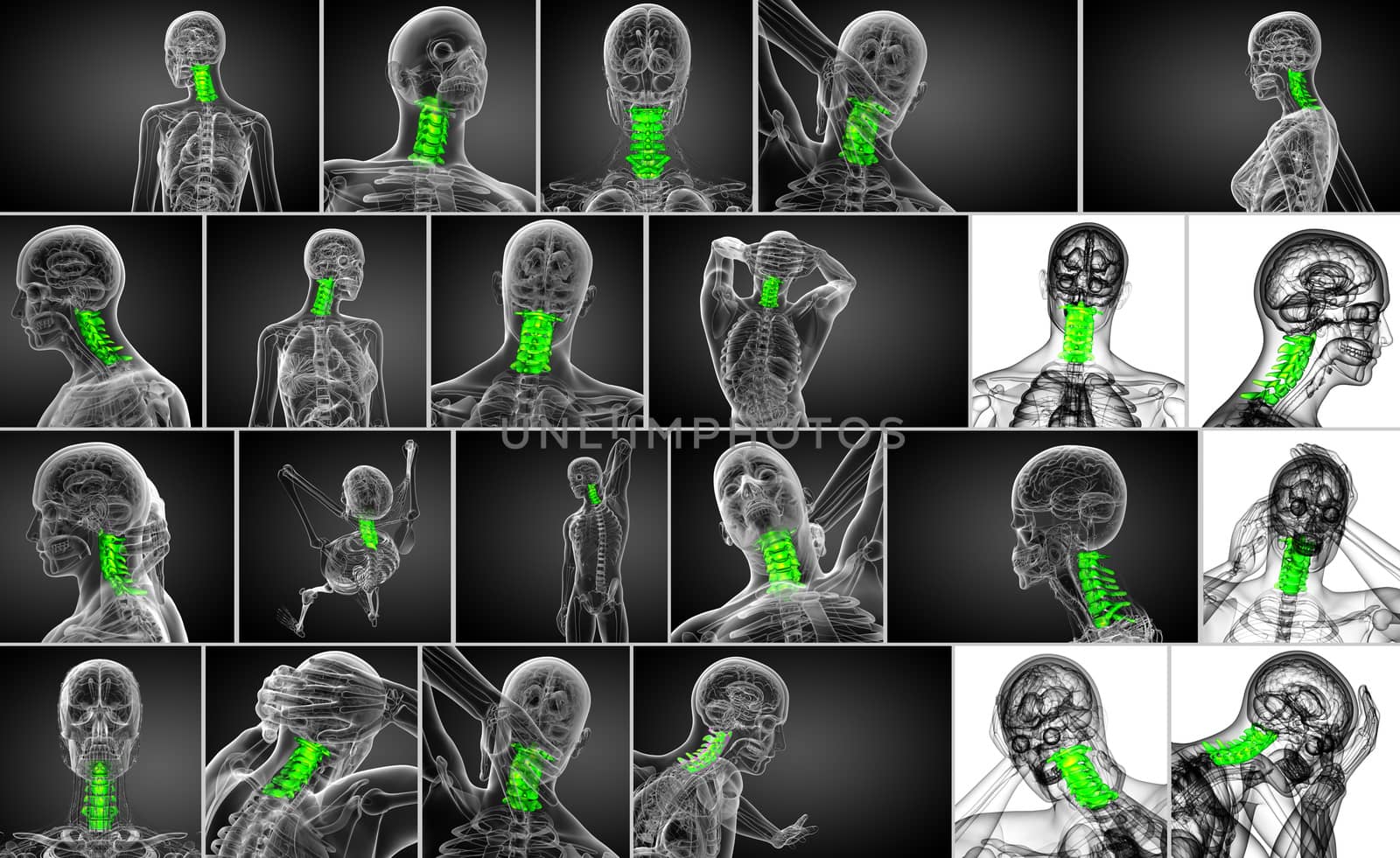 3d rendering medical illustration of the cervical spine