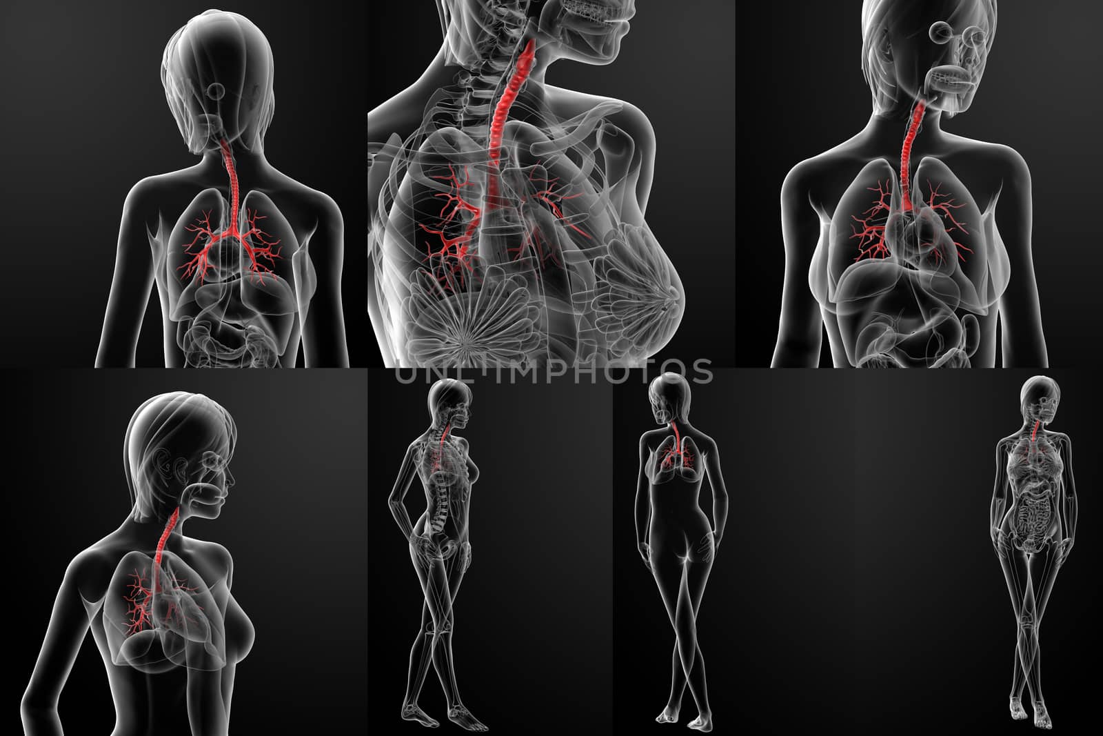 3d rendering of the bronchi