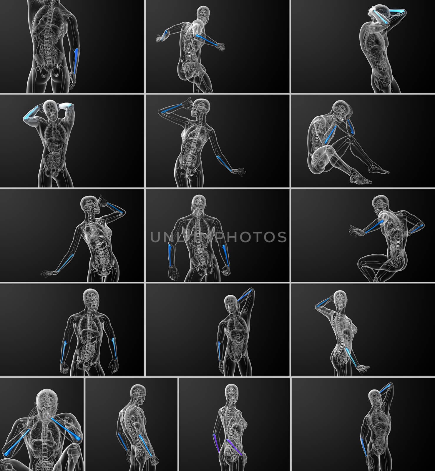 3d rendering medical illustration of the ulna bone 