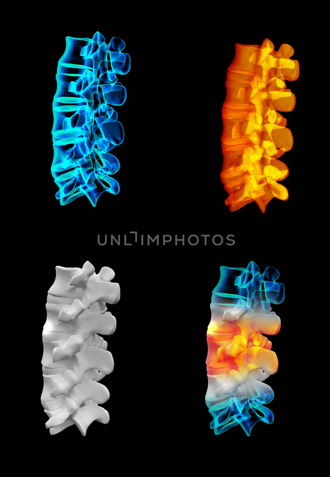 3D rendering human with the backbone