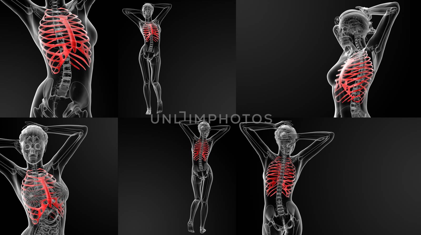 3D rendering illustration of the ribcage bone