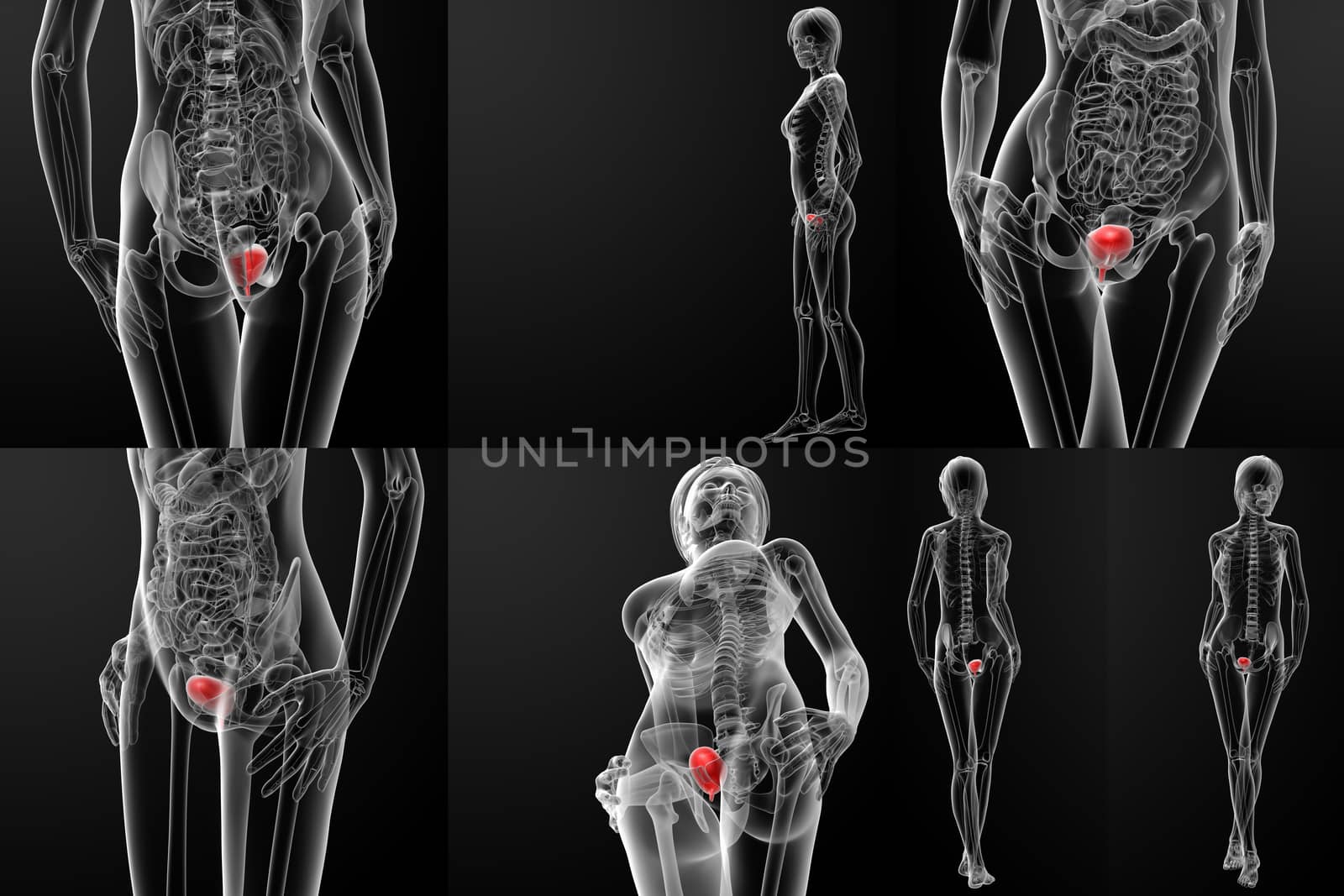 3d rendering of female bladder anatomy x-ray