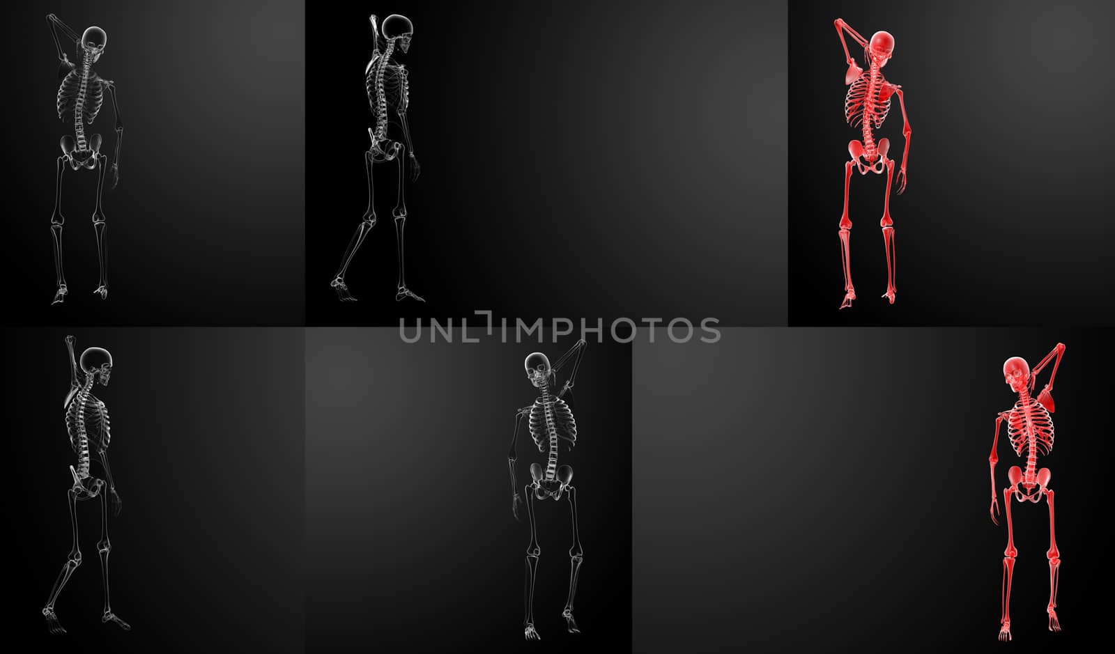 3d rendering Skeleton X-rays 