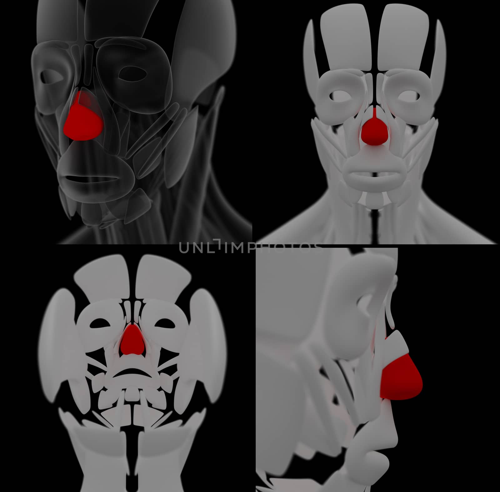 medical illustration of the Dilator Naris