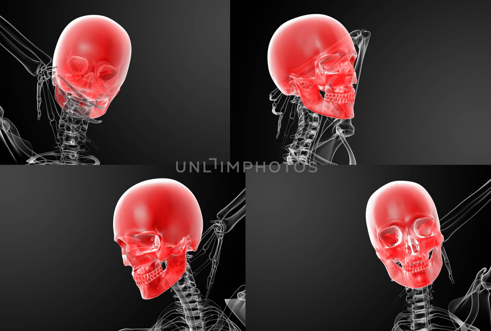 3d rendering skull X-rays