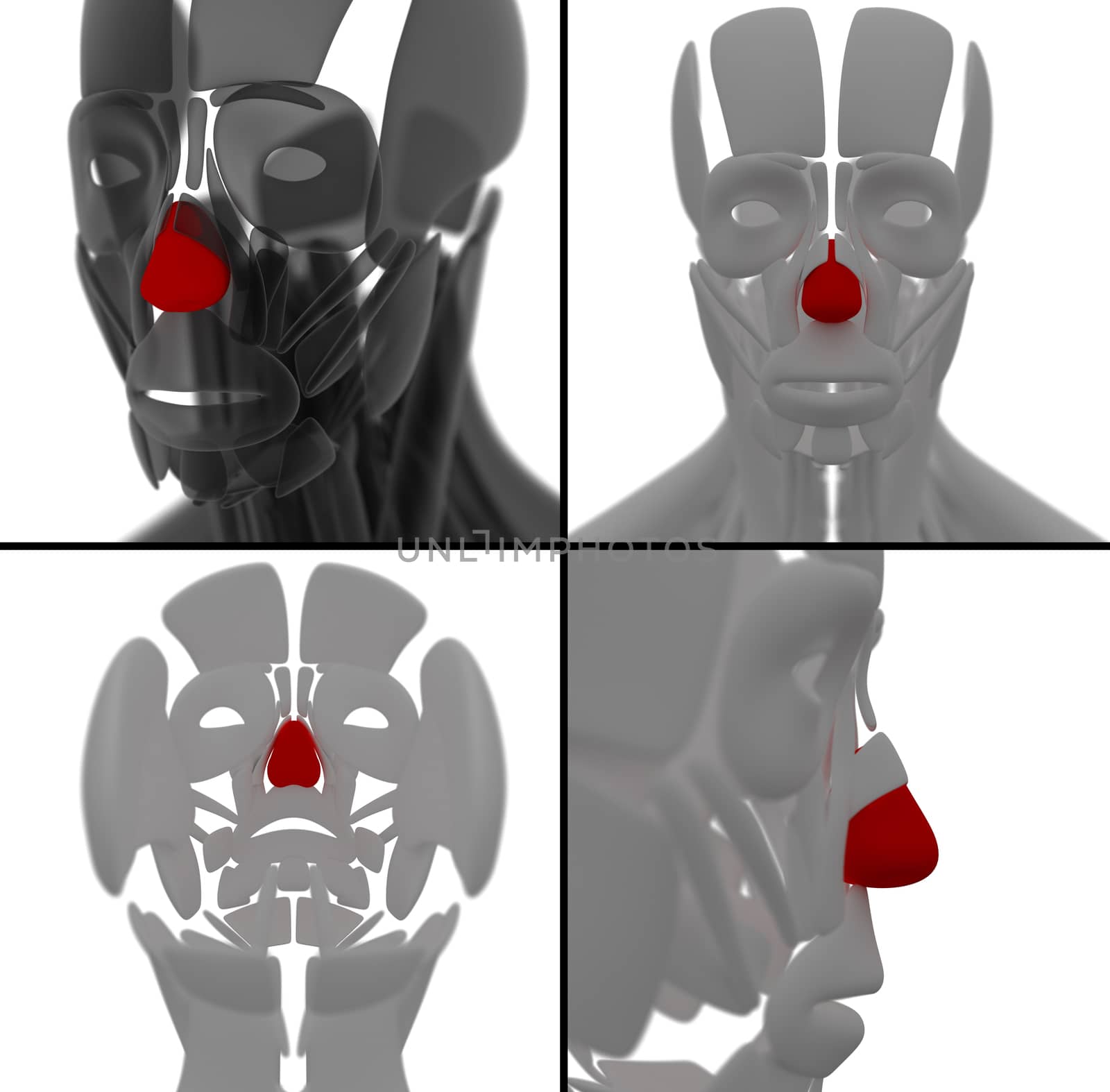 medical illustration of the Dilator Naris
