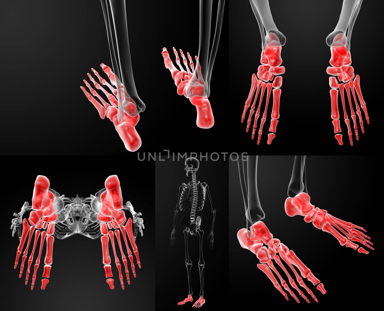 3d rendering of human foot x - ray