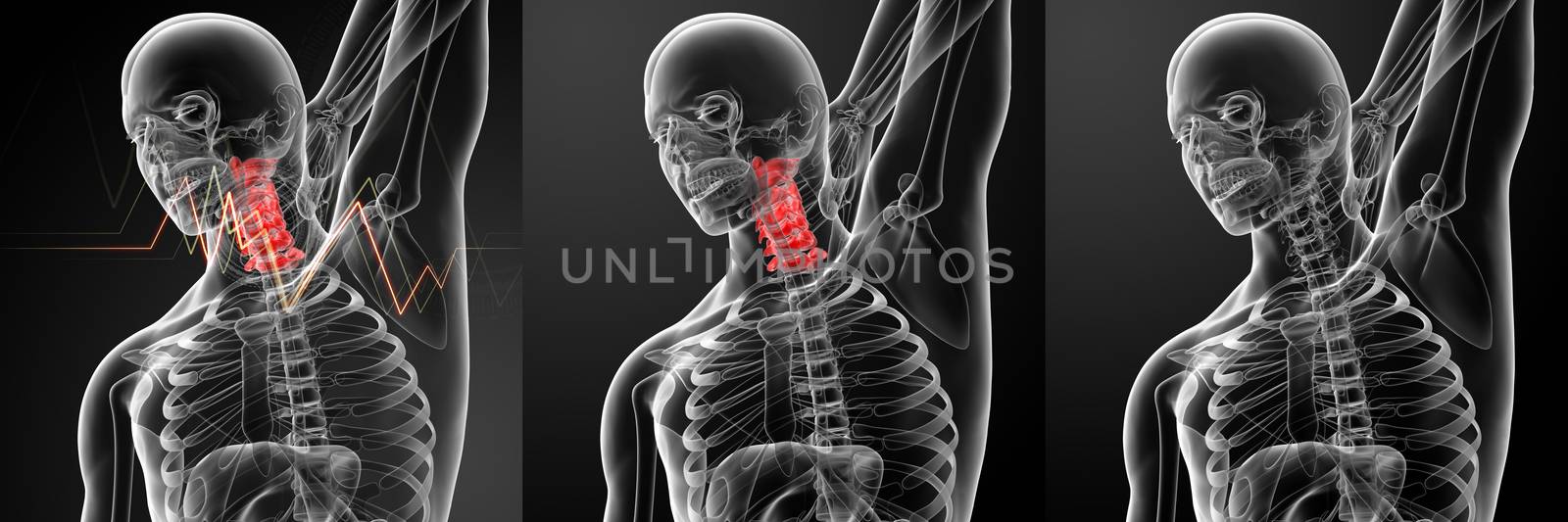 3d rendering illustration - pain neck by maya2008