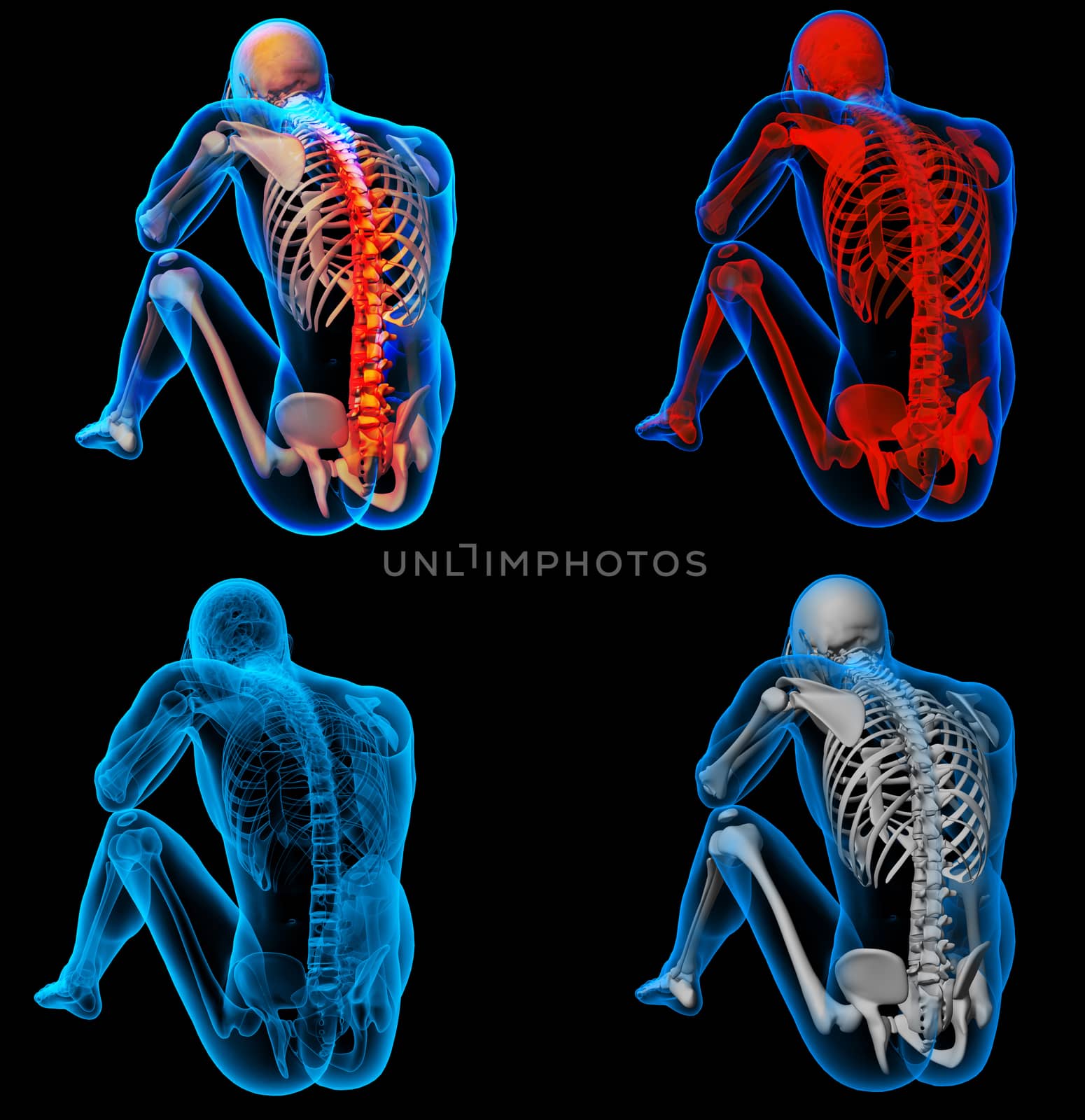 3D rendering skeleton of the man with the backbone