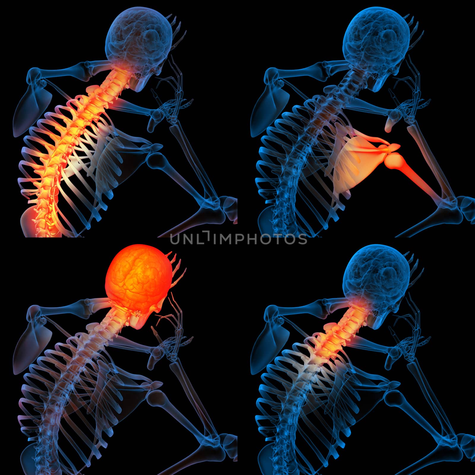 3d render skeleton of the man with the painful