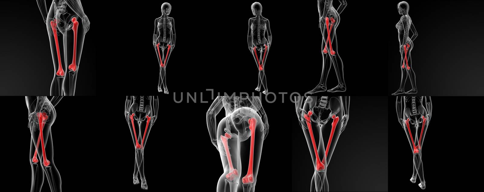 3D rendering illustration of the femur bone