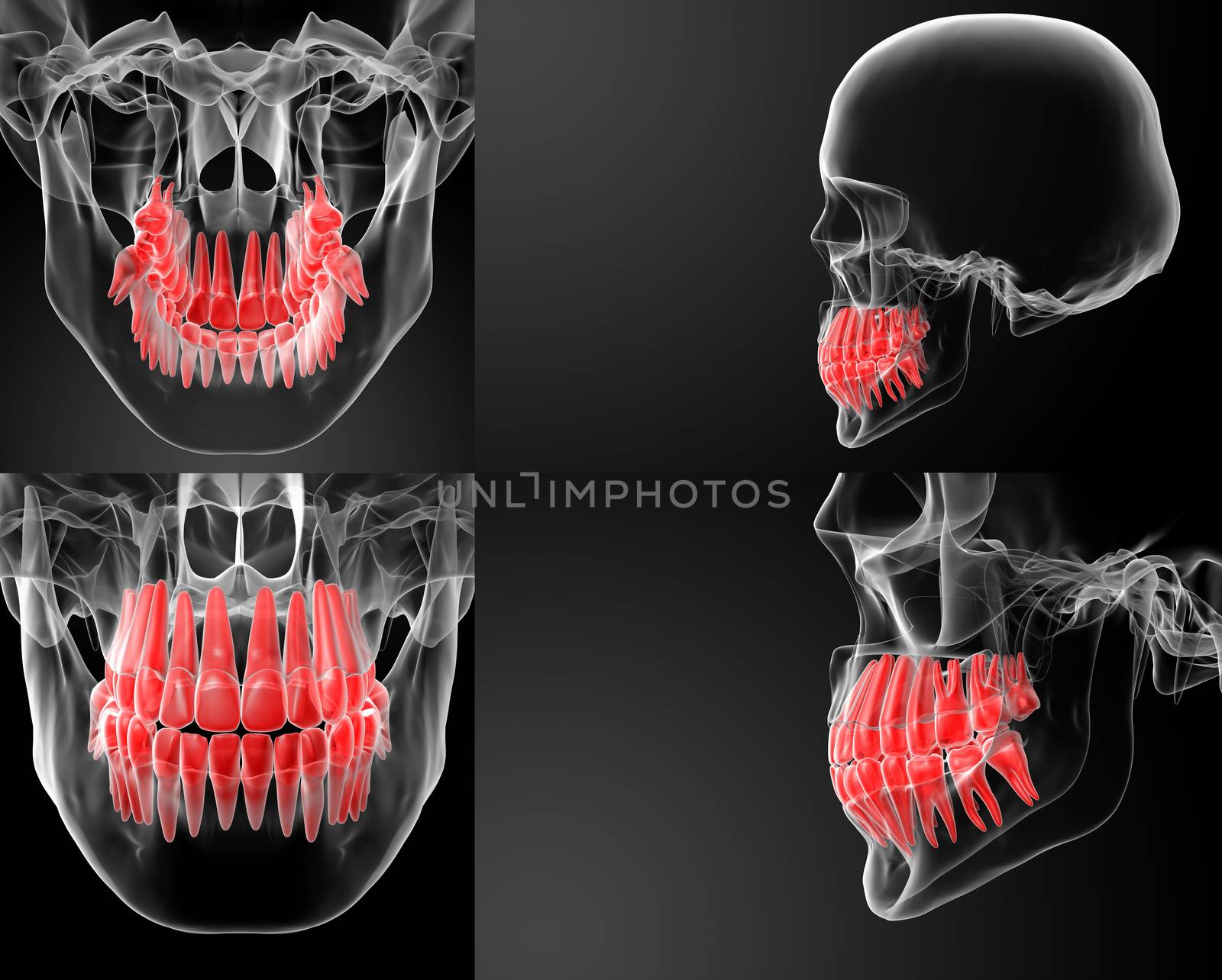 3D rendering skull with visible red teeth