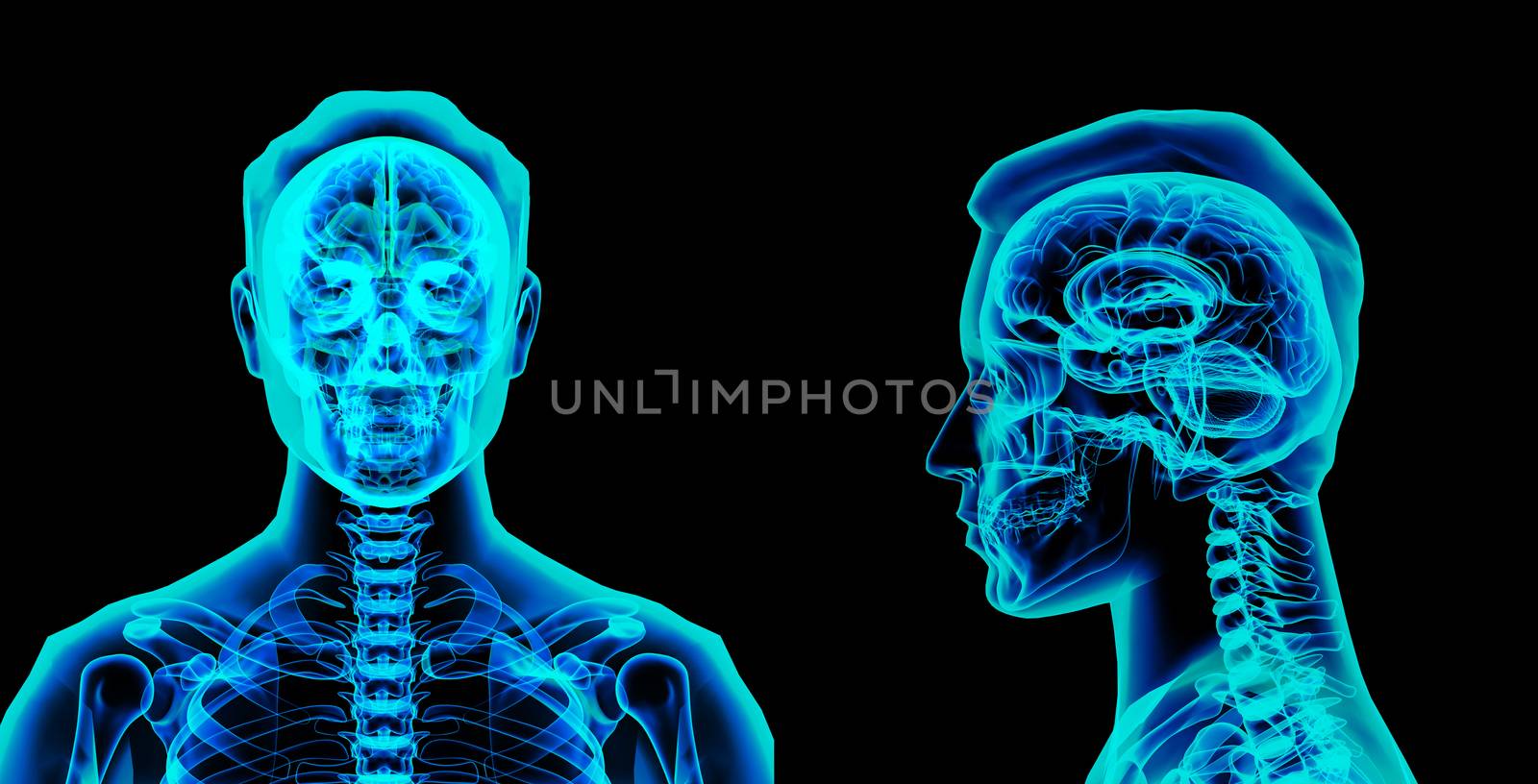 3d rendered illustration of the brain