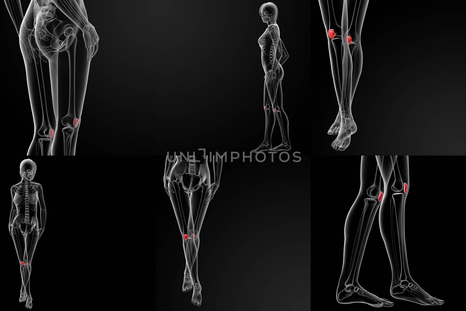 3D rendering illustration of the  patella bone 