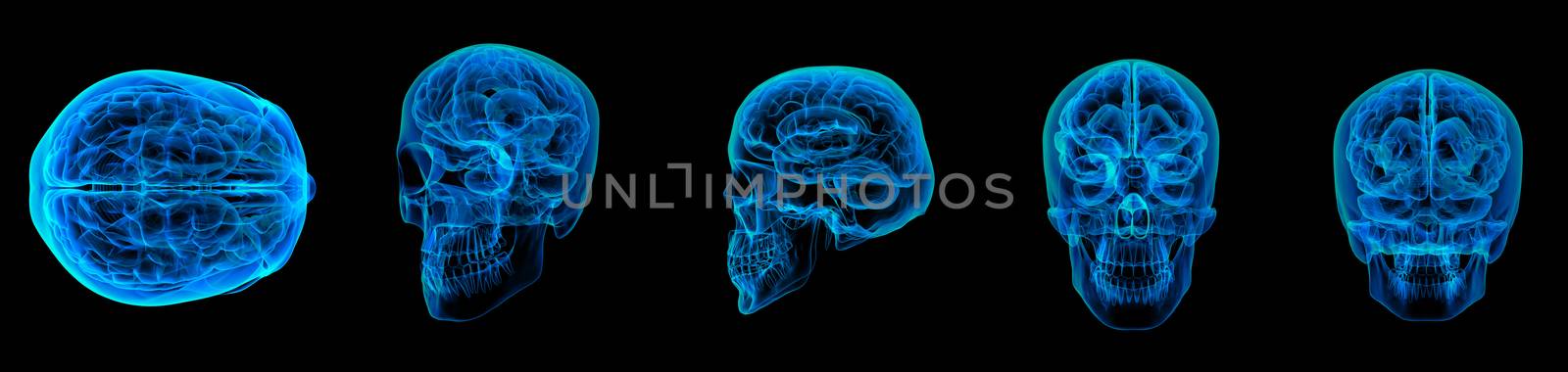 3d render human brain X ray 