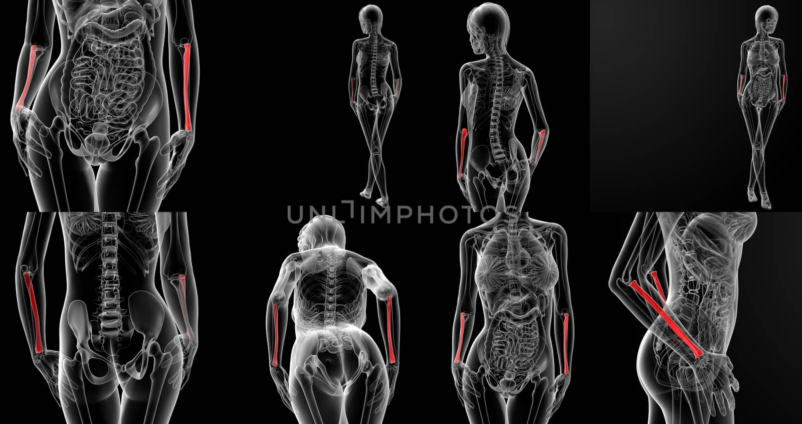 3D rendering illustration of the  radius bone