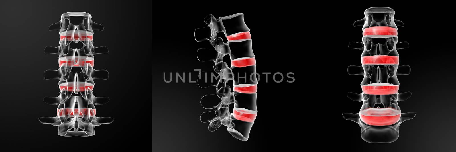 3d rendering of  human intervertebral discs 