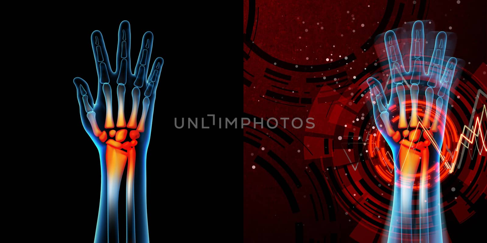 3d rendered anatomy illustration - hand pain