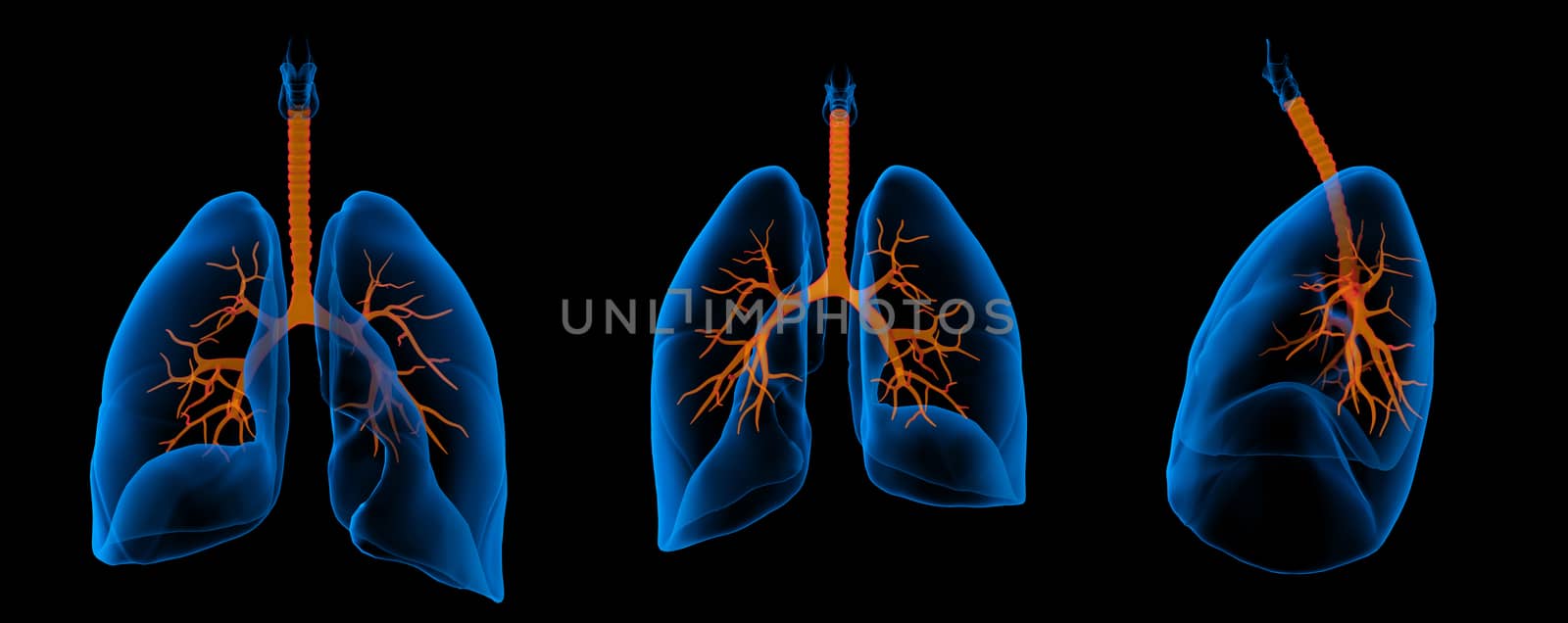 3D medical illustration - lungs with visible bronchi  by maya2008