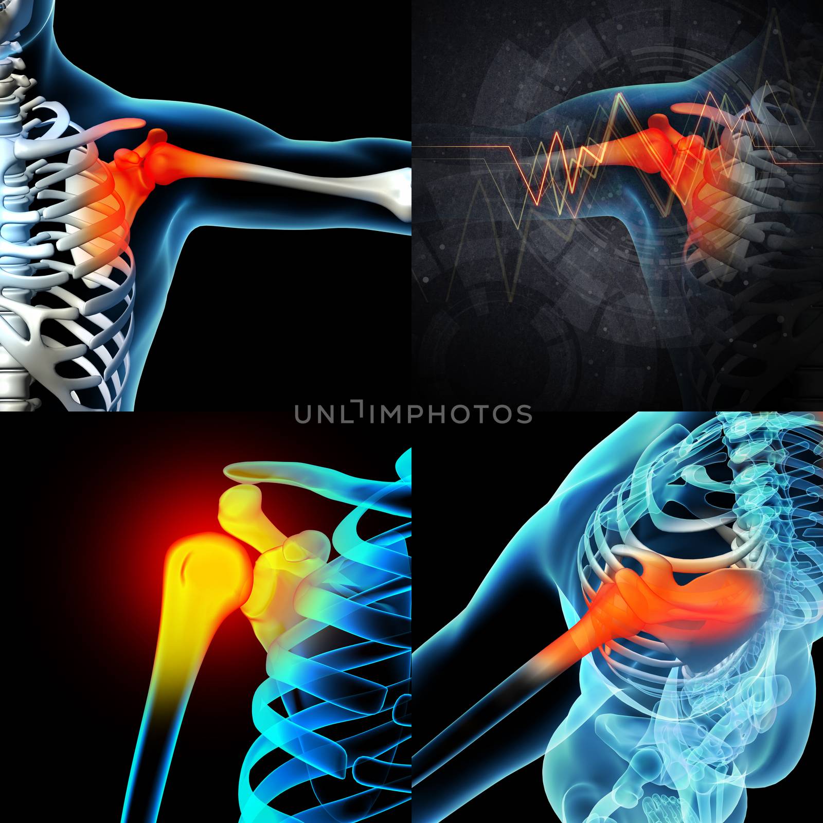 3D rendering human shoulder pain with the anatomy of a skeleton shoulder