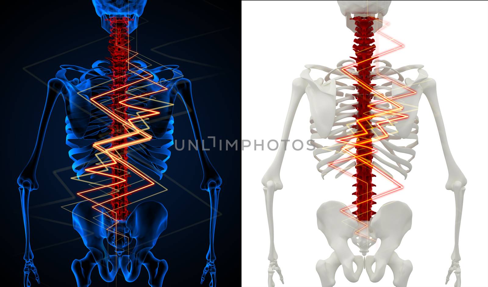 3d rendering skeleton of the man with the backache