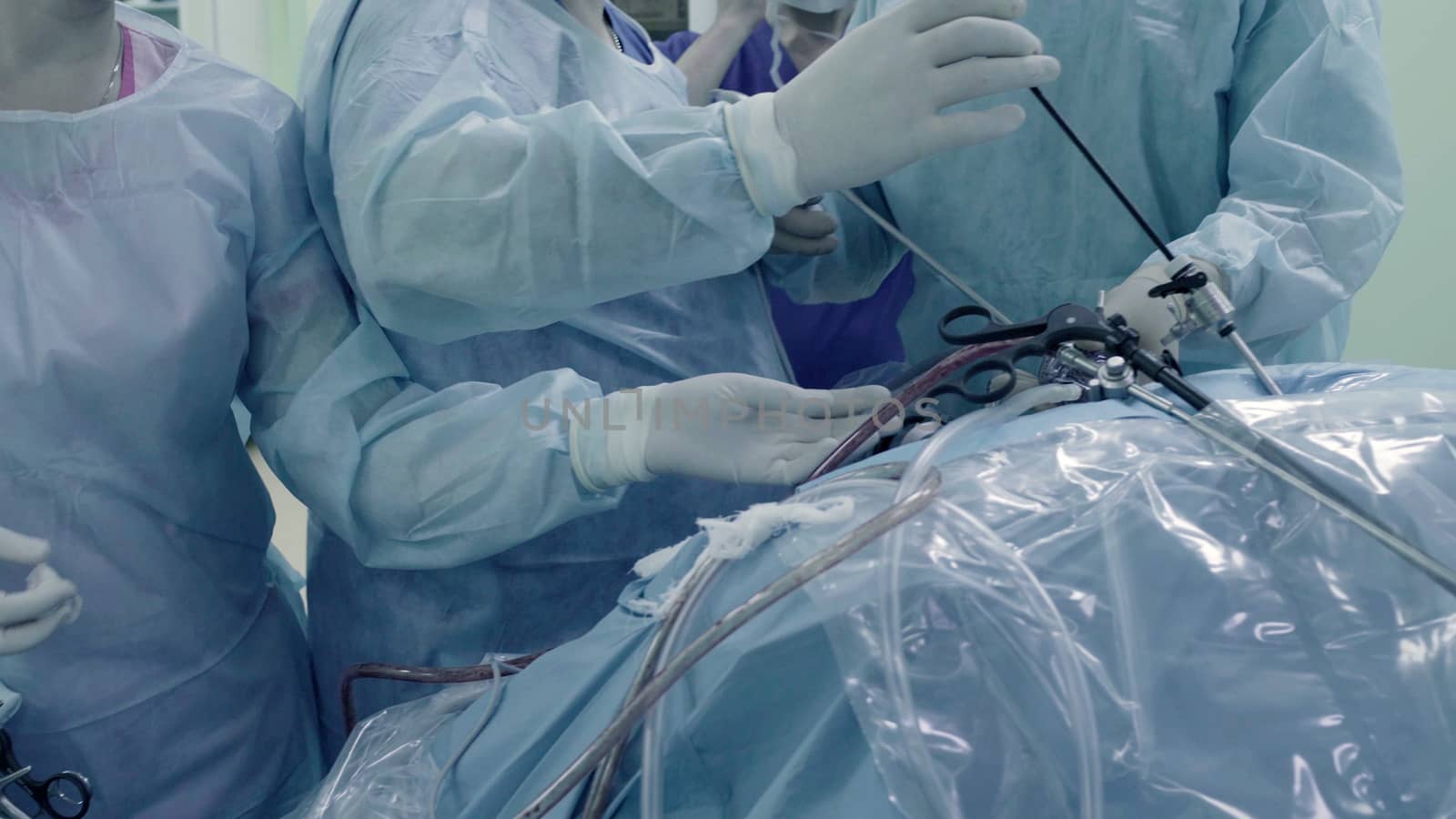 Laparoscopic surgery of the abdomen by Chudakov