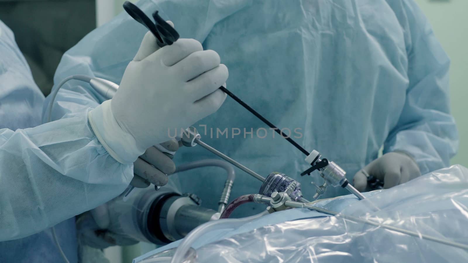 Laparoscopic surgery of the abdomen by Chudakov