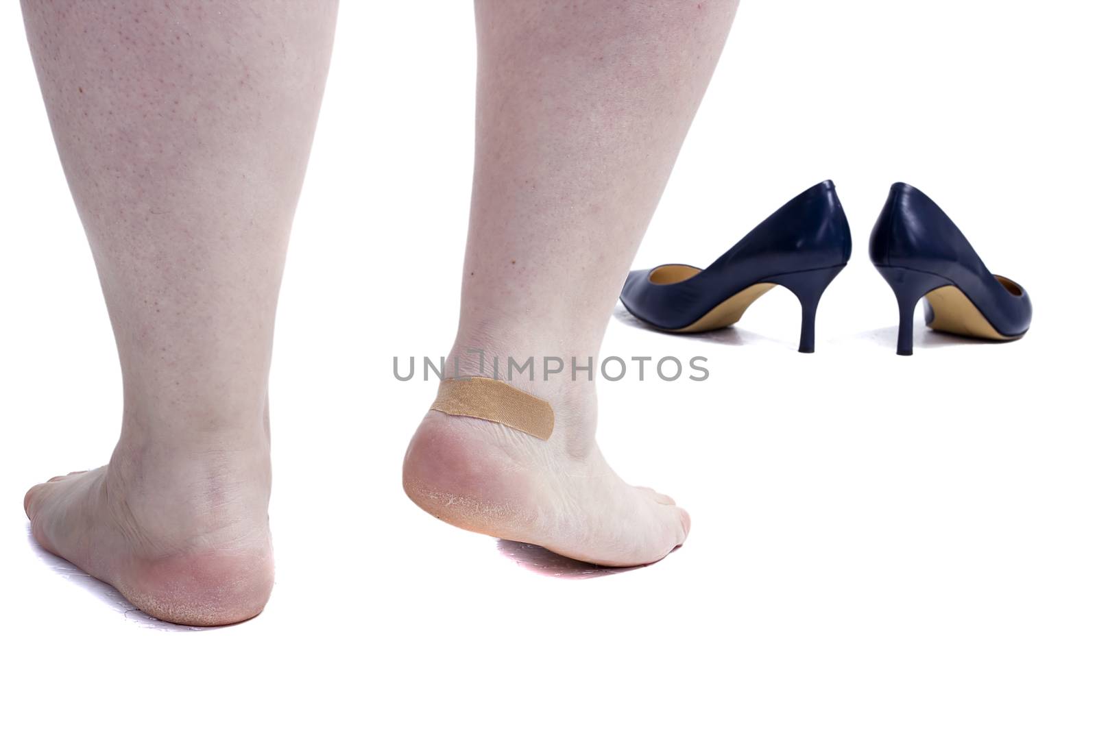Female legs with plaster and shoes on white background