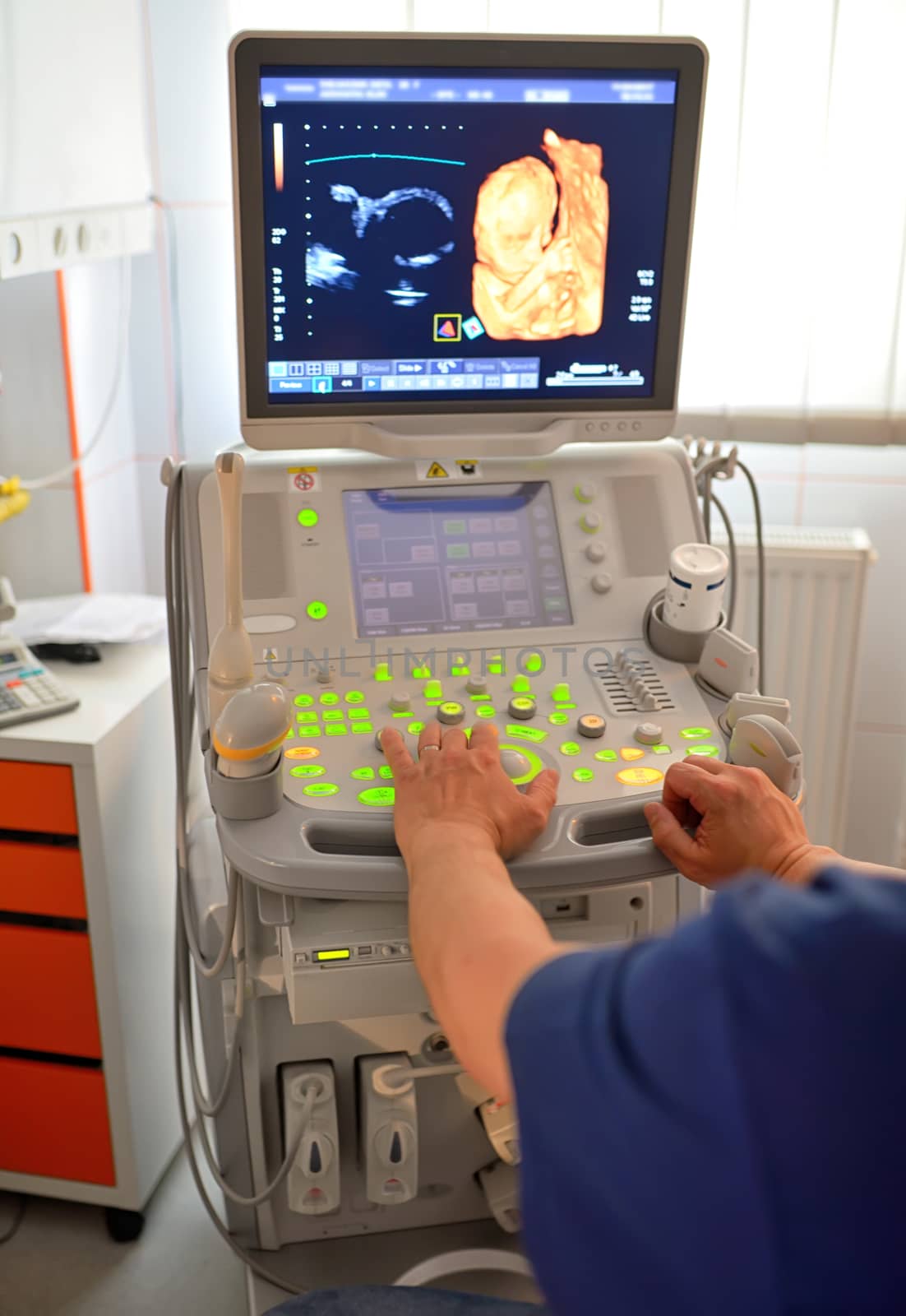 Doctor Examining Pregnant Belly By Ultrasonic Scan