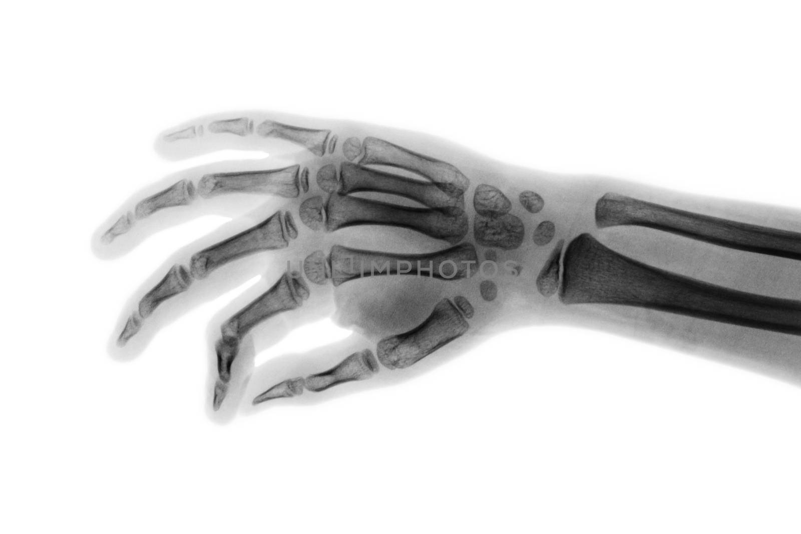 Film x-ray hand of child . Oblique view by stockdevil