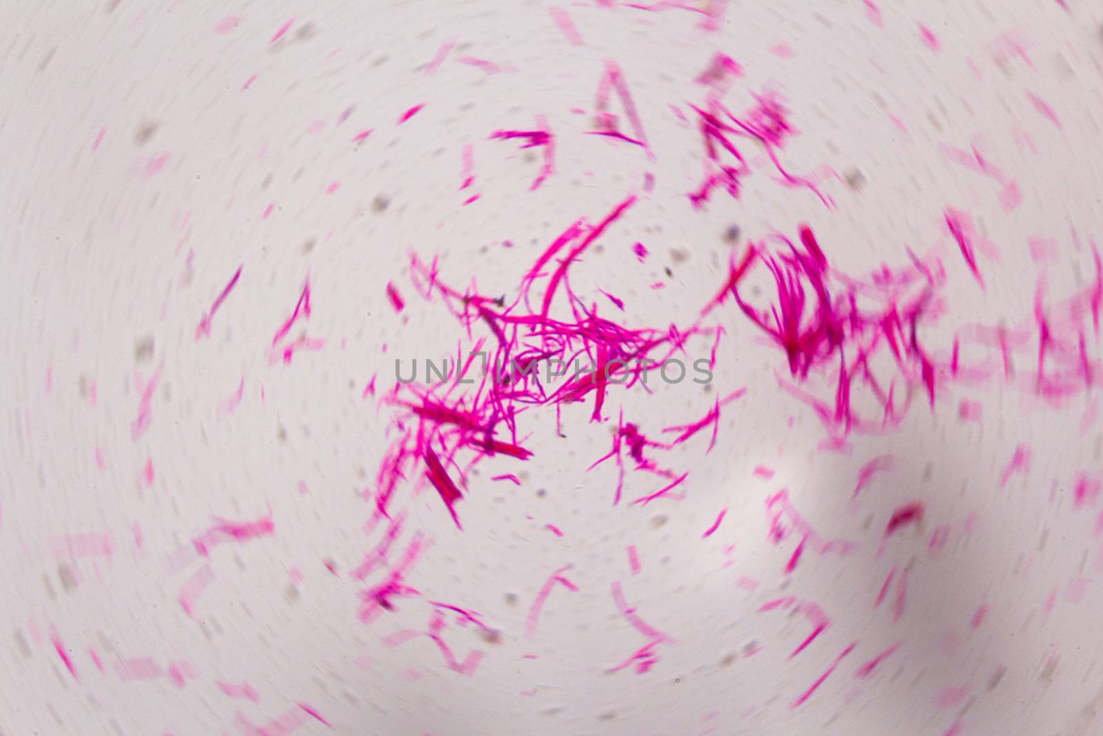 Smooth muscle separate under the microscope - Abstract pink lines on white background.