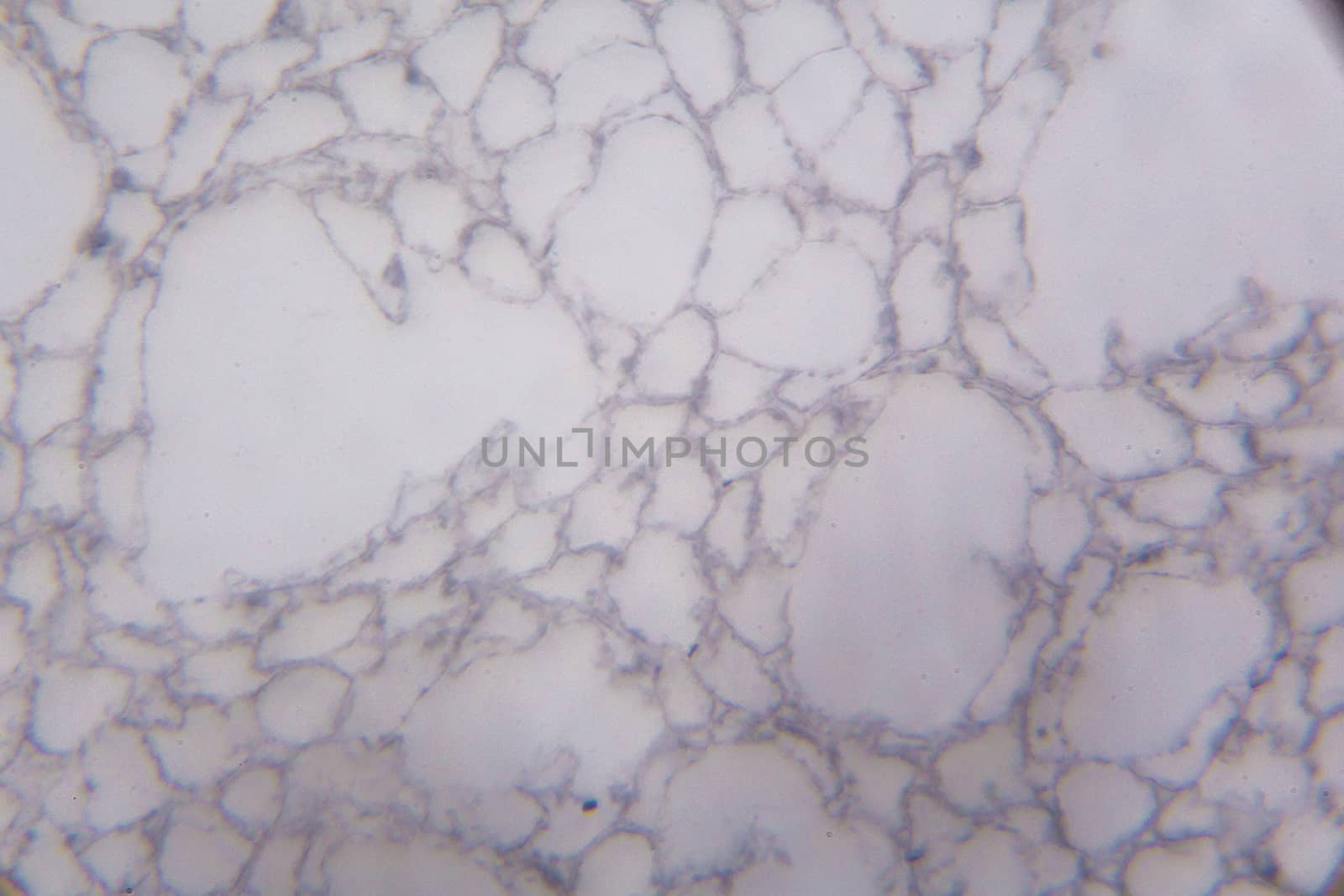 Agaricus section under the microscope.