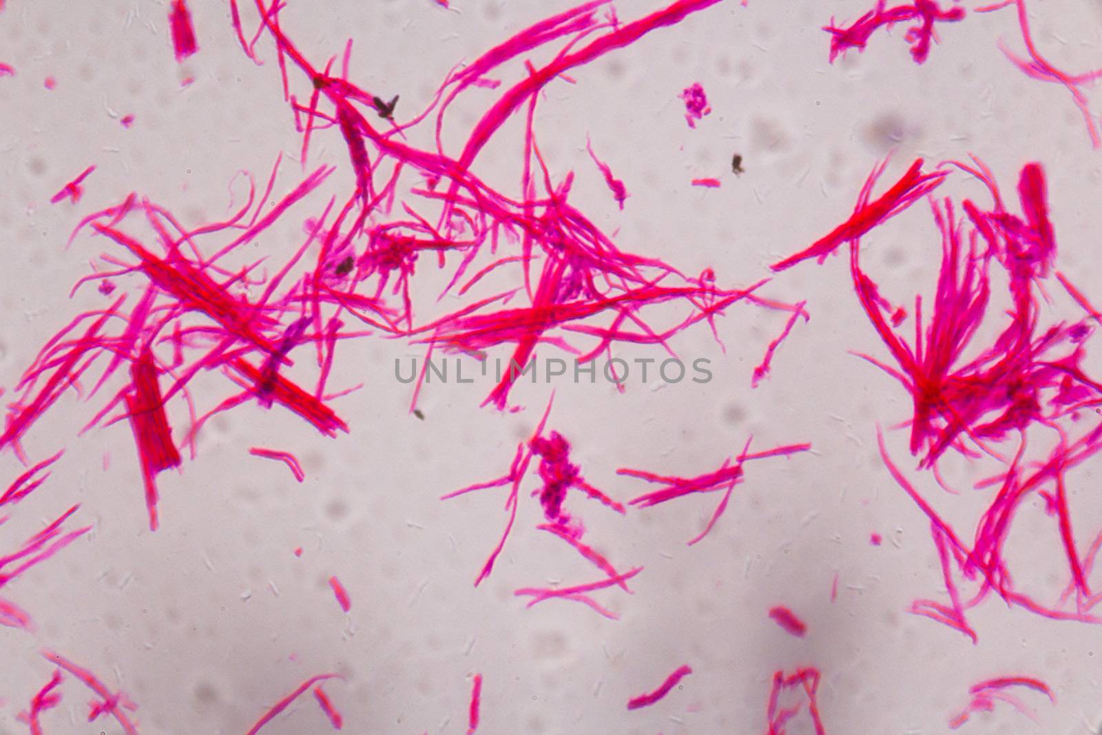 Smooth muscle separate under the microscope - Abstract pink lines on white background.