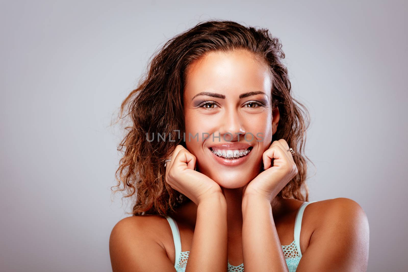 Portait of a smiling young woman showing her perfect white teeth with braces. Looking at camera.