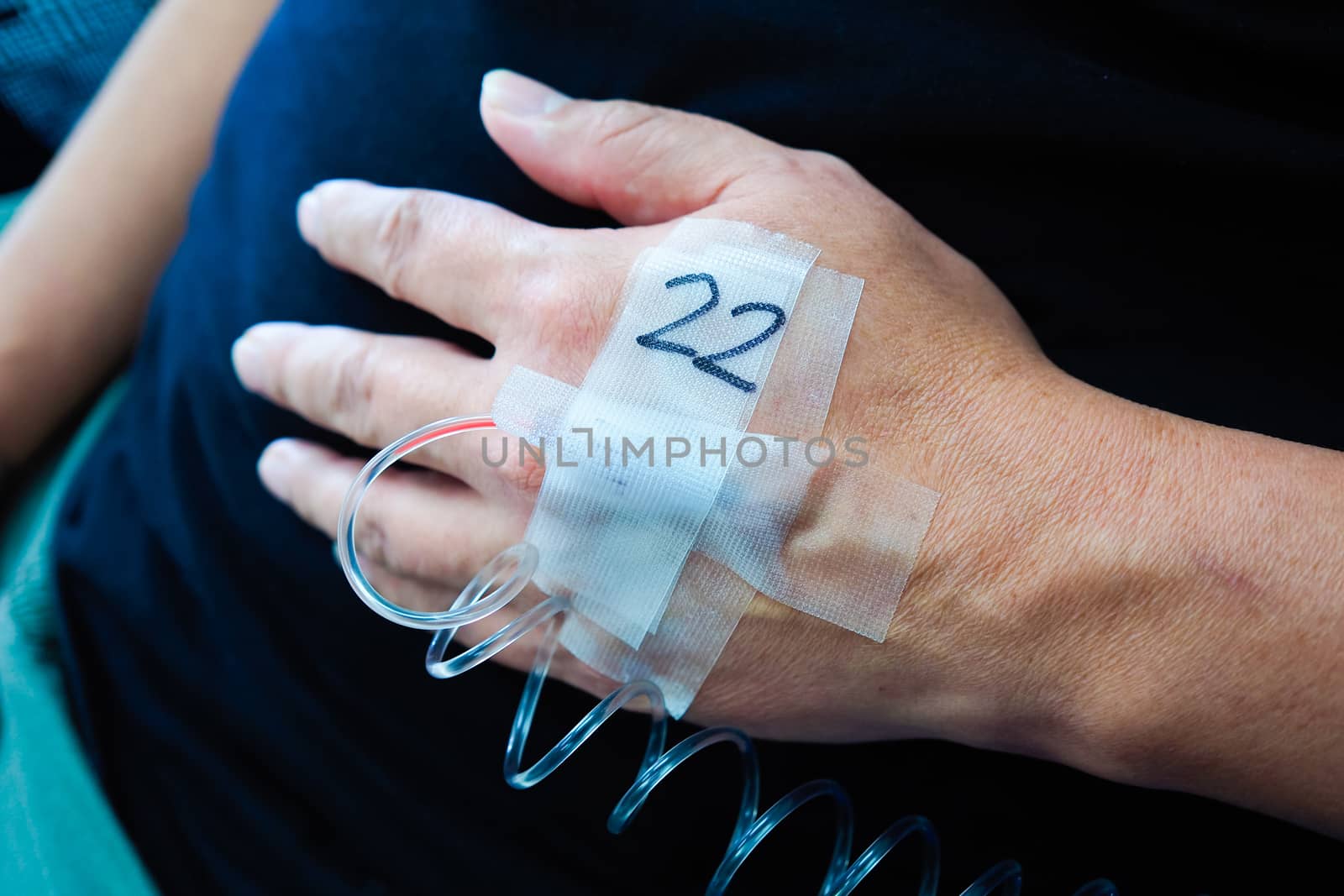 A man patient in hospital with saline and disinfectant.