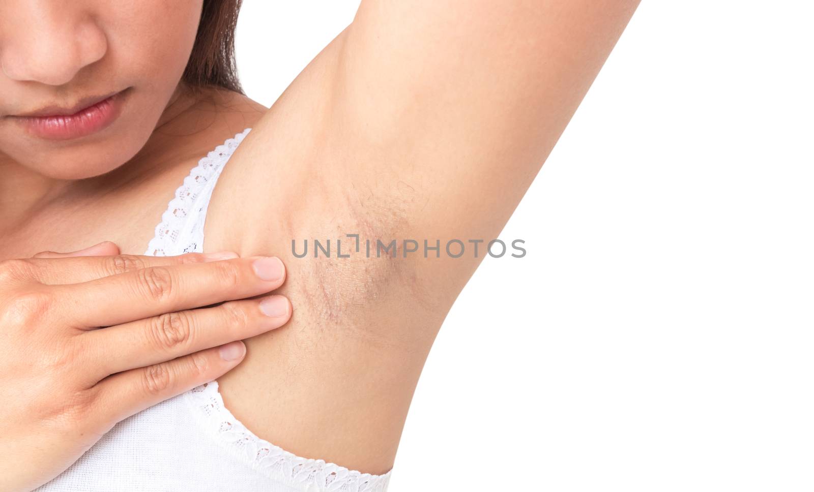 Women problem black armpit on white background for skin care and beauty concept