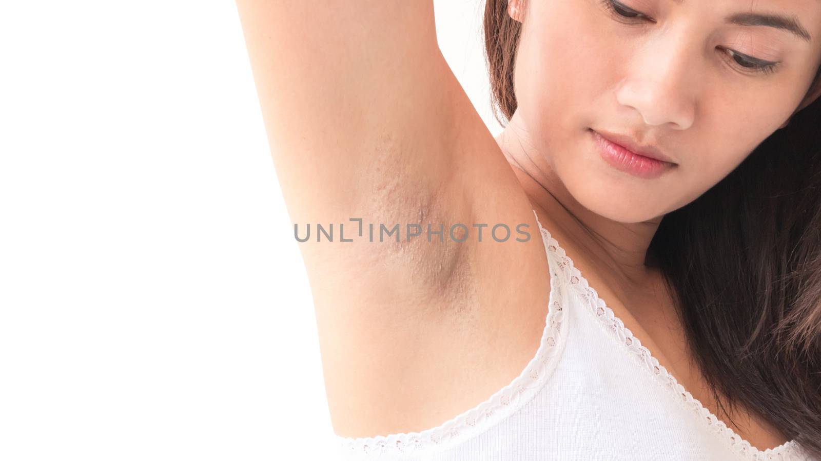 Women problem black armpit on white background for skin care and by pt.pongsak@gmail.com