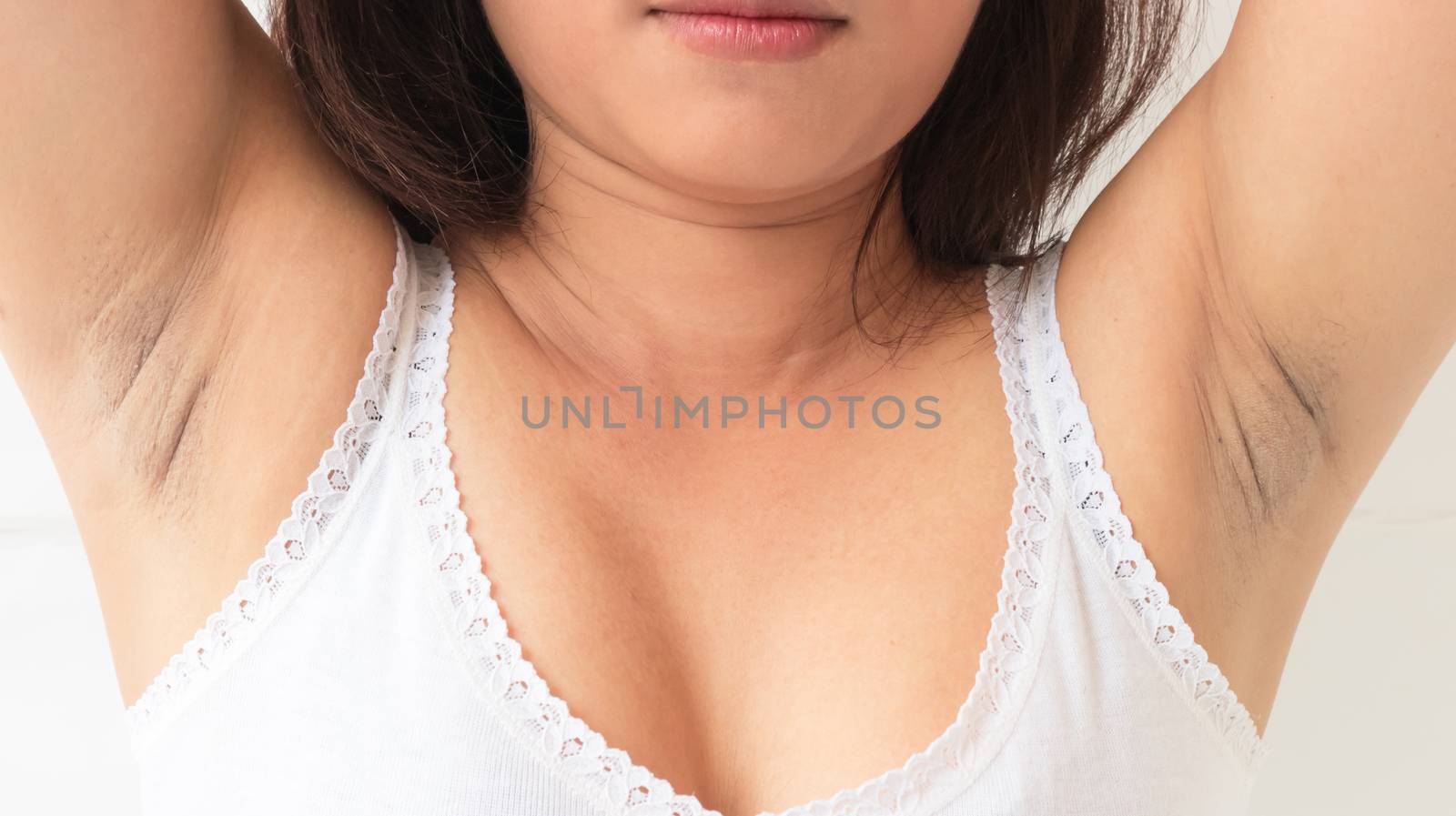 Women problem black armpit on white background for skin care and by pt.pongsak@gmail.com