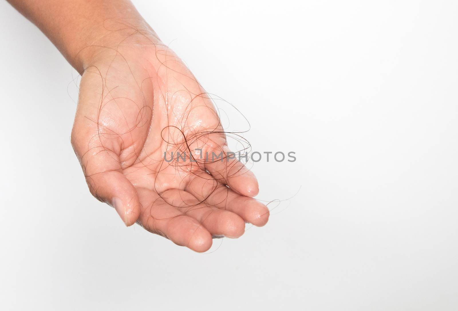 Closeup Hair loss on woman hand on white background 27-3-17