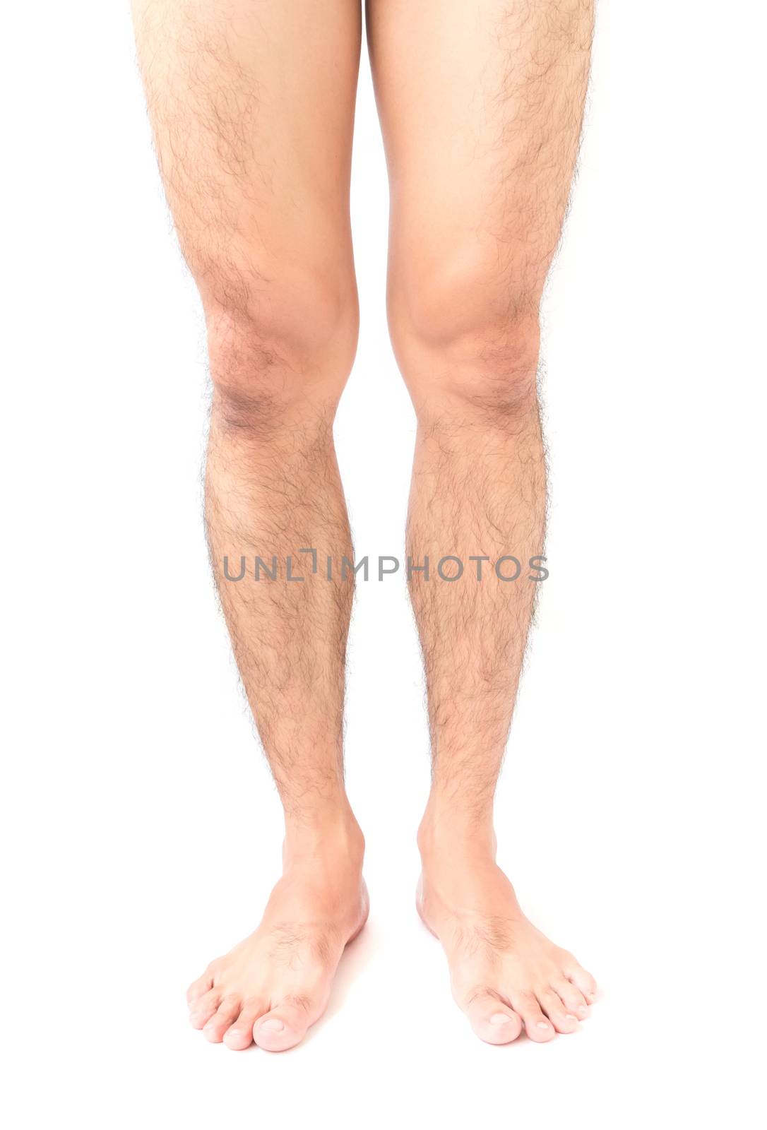 Closeup legs men skin and hairy with white background, health ca by pt.pongsak@gmail.com