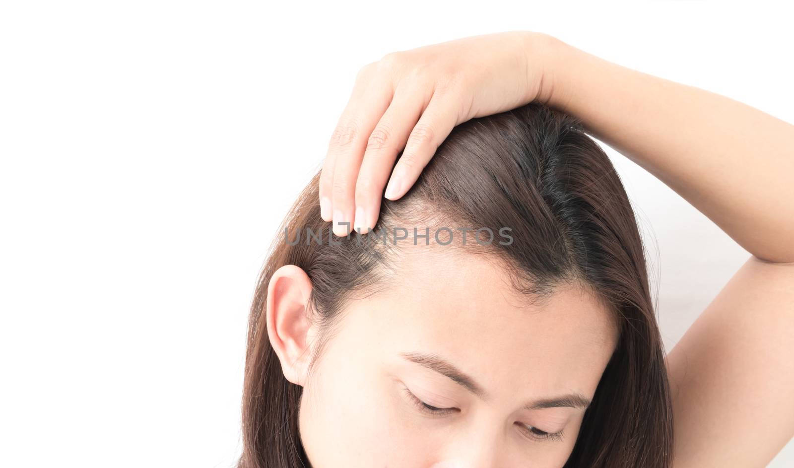 Woman serious hair loss problem for health care shampoo and beau by pt.pongsak@gmail.com