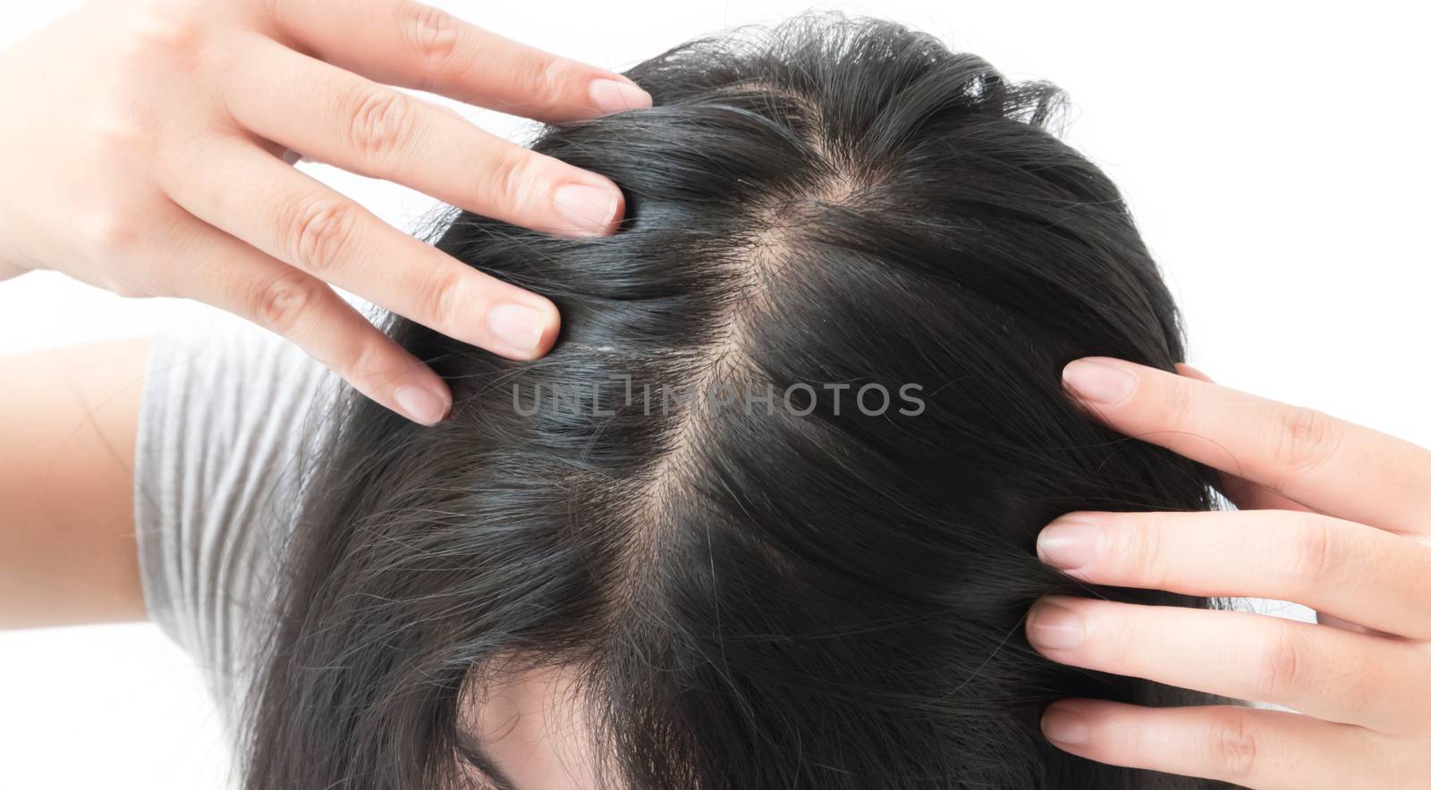 Woman serious hair loss problem for health care shampoo and beauty product concept